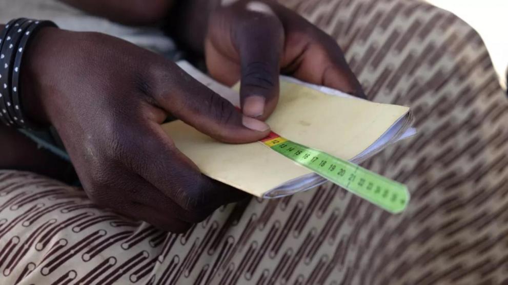 Identifier la malnutrition pour soulager plus rapidement les enfants malades au Burkina Faso